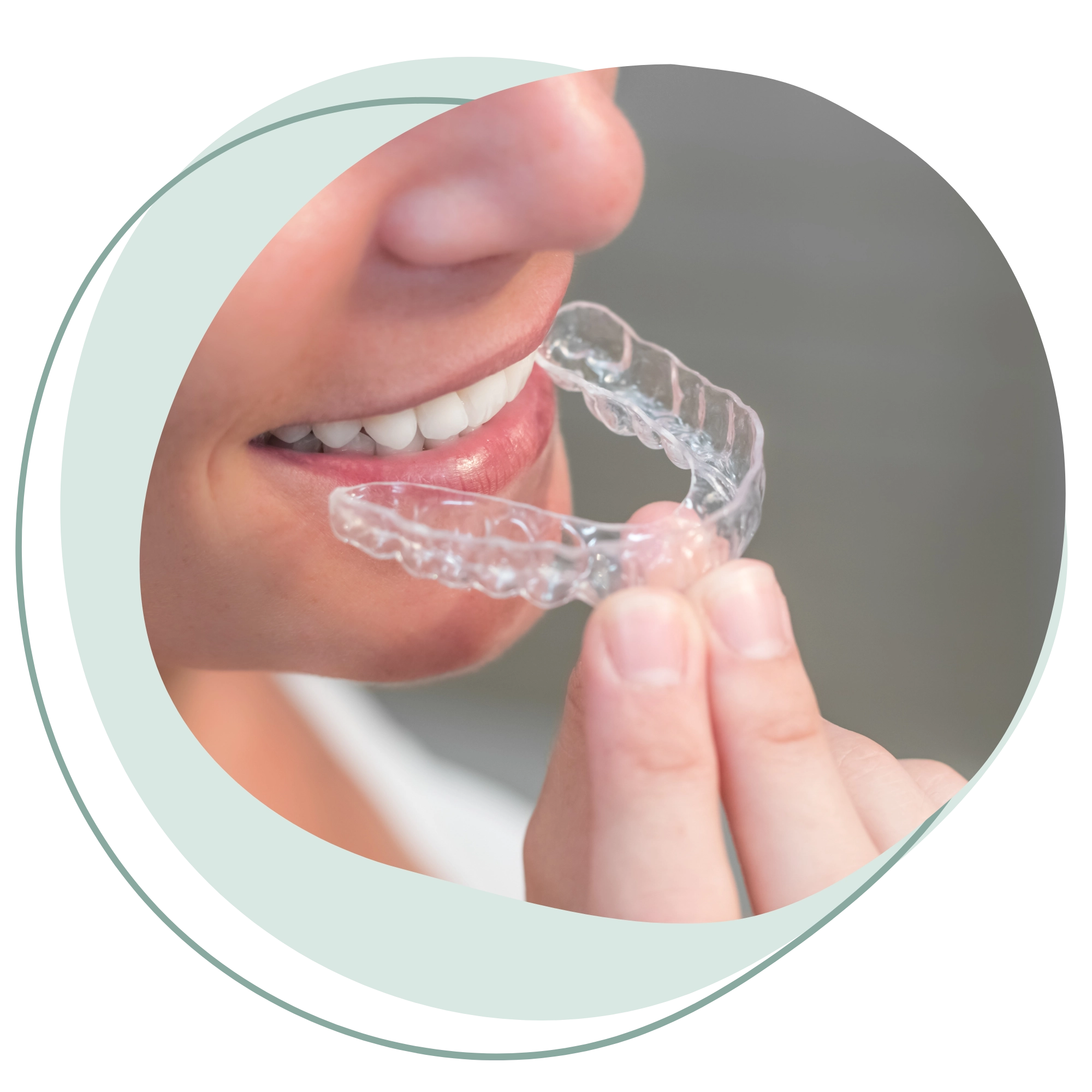 Invisalign